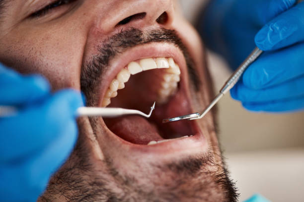 Best Emergency Treatment for Toothache in Union City, MI