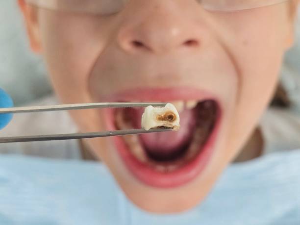Best After-Hours Emergency Dentist in Union City, MI